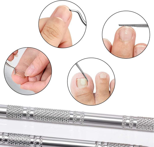 Eckenheber - Ein vielseitiges Werkzeug für die Nagelpflege