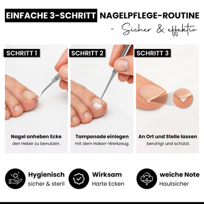 Tamponadensonde & Wattehaken für eingewachsene Fußnägel – Set mit 2 Tamponaden – Nagelpflege-Instrument aus Edelstahl