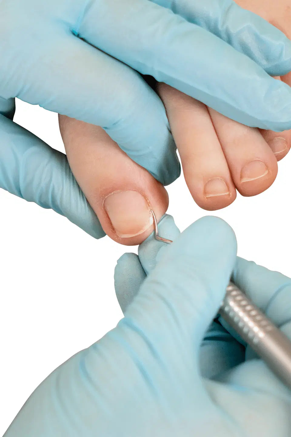 RUCK® Nagelheber doppelseitig - leichte Form