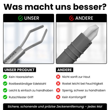 Zeckenzange mit Haltebuegel - rostfreier Edelstahl - ideal geeignet für Haustiere